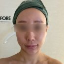 E.K 뷰티앤바디 | 철산피부관리 스킨앤바디포레 리프팅관리 받고 온 후기