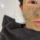 오늘도미쁘다 - 북구 | [대구 북구 피부관리] 오늘도 미쁘다 여드름 칠곡 동천동 에스테틱
