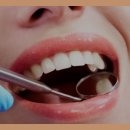 칠곡스마일치과교정과치과의원 | 대구국우동치과 클리피씨교정 기존 교정과 차이점