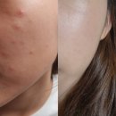 태리약국 | &lt;마감&gt; 크림 2종 특가!! 4개씩 구매시 초초특가!!