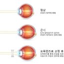 호야안경 이미지