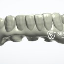 누리치과기공소 이미지