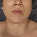 블랙로터스 | 강남피부관리 로터스에스떼 모공,피지고민 해결 디톡스 프로그램 솔직후기