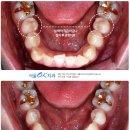 OK치과기공소 이미지