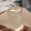 나라메드 이미지