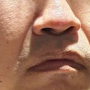 링클스탑의원 이미지