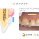 바른정치과 네이버블로그