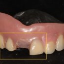 메디포레치과의원 이미지