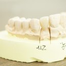 프라임치과기공소 이미지