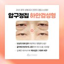 압구정집성형외과 이미지