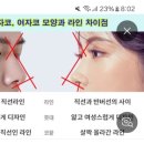 아니 남자들 자뻐지는건 좋은데 왤케 다들 남자코를 버선코로 수술하는건데?? ㄹㅇ 성형외과의사들 미감 문제있는거 확실함 이미지