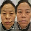 인셀덤 day | 인셀덤화장품후기 아름다운 동안피부를 위한 인셀덤 비비데이!!!