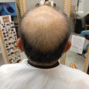 포르모 주차장 입구 이미지