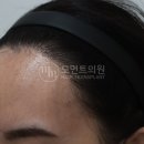 동경헤어라인
