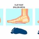 대구보조기 이미지
