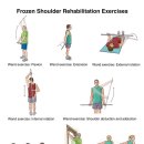 오십견(Adhesive Capsulitis), 동결견(frozen shoulder) 이미지