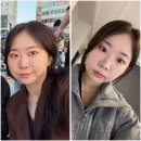 온천장역_부산1호선 | 동래 피부과 '레디어스' 후기 팔자주름, 눈밑꺼짐 해결!! 공장형X