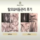 황학상회 | 탈모의 원인 해결방법이 있을까요?