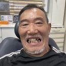 앞 니 빠 진 개오지 ㅡ 웃 도랑에 가지마 이미지
