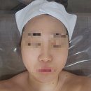 김제 에스테틱 '더가꿈'오투덤 산소테라피 후기
