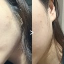 스킨테라피 | 울산 울주군 구영리 피부관리 에스테틱 5회차 스킨테라피 후기