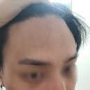 픽스컴퓨터 - 창원시 마산합포구 진동시장길 62 | 중요한 일정 전날 제가 찾게 된 주름케어 제품 리프넬 이마 픽스 패치 후기