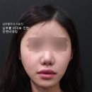 윤곽