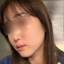 루카스병원 | 코레지셀핏과 클라리티2와 루카스토닝 1차 받은 후기