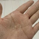 위잉 | [편백 살충제 추천 벌레 관리 걱정줄인 사용 후기] - 위잉 편백 살충제 스프레이