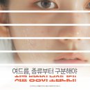 세종퍼스트피부과의원 네이버블로그