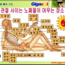 대한민국에서 가장 많이 받는 수술-치질 이미지