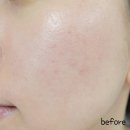 <b>큐어</b><b>31</b> 소나무 앰플 늘어진 모공 쫀쫀하게