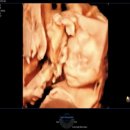 목포미즈아이병원 이미지