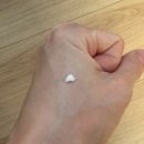 등임 | 등 피지낭종 제거 후기