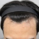 모나라피부과의원 이미지