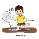 메리오이드증(Melioidosis) 증상 이미지