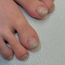 레푸스 부산사직점 | 부산 발굳은살 관리, 레푸스 부산사직점 :: 발각질 제거 후 유지 관리가 중요한 이유?!