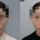 바이미성형외과의원 이미지