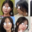 나노성형외과의원 이미지