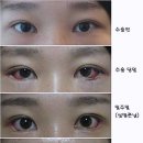 에스라인 이미지