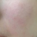 대화약국 | 약국 착색크림 멜라토닝크림 사용법 효과? 부작용? 총 정리