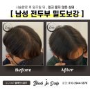 블랙인스칼프 이미지