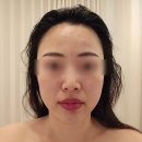 김천피부관리 디자인라인스튜디오 채움실 솔직후기