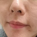 람스킨케어