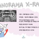 서울완치과 이미지