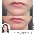 청아한에스떼