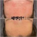 쏠뷰티스킨케어