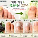 지긋지긋한 발톱무좀, 저는 이렇게 극복했습니다 😊수년간 고생했던 발톱무좀, 여러 시행착오 끝에 찾은...