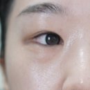 진동 | 메디필 레티날NMN바운스샷아이크림 진동 디바이스 일체형 후기