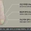 더발즈